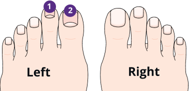 A diagram of two feet